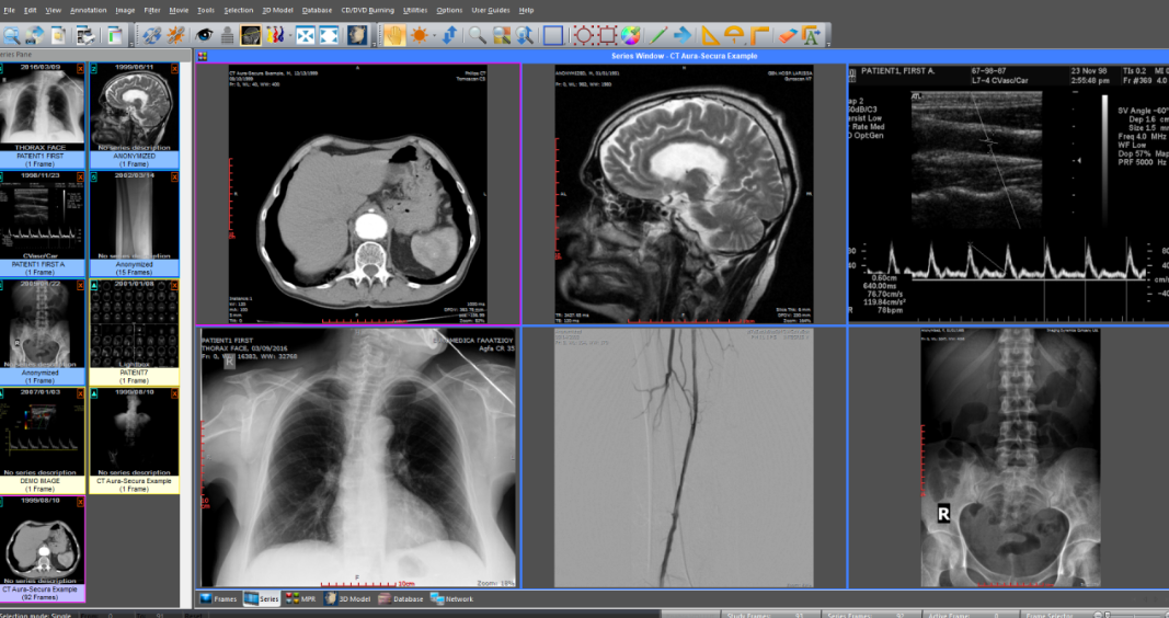 Sante DICOM Editor